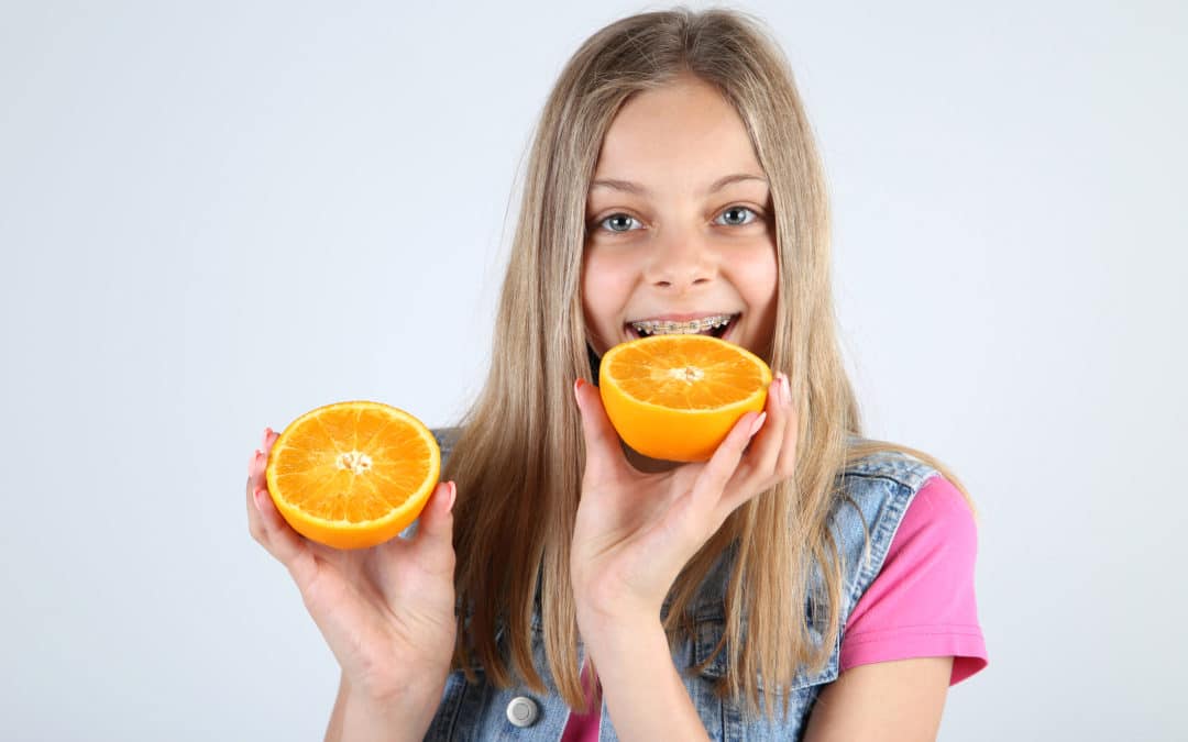 Tooth-Healthy Foods You Can Still Eat with Braces