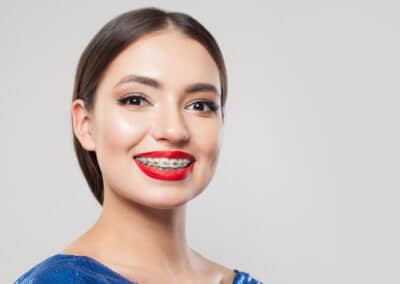 All You Need to Know About Adult Orthodontics